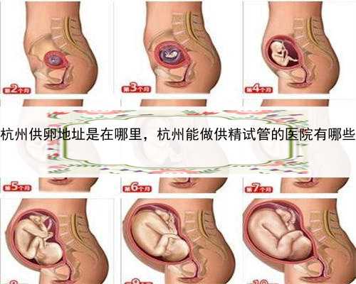 代孕公司包生双胞胎，杭州供卵地址是在哪里，杭州能做供精试管的医院有哪些