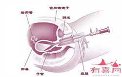 助孕在郑州违法吗，郑州女性做输卵管通液疼吗